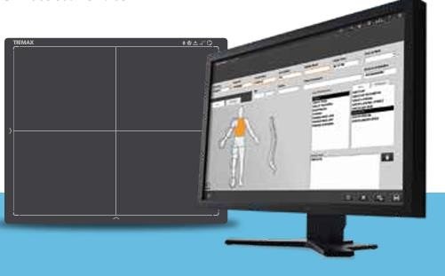 Carestream Trimax imaging detector supplied by Sahara Medika Prima