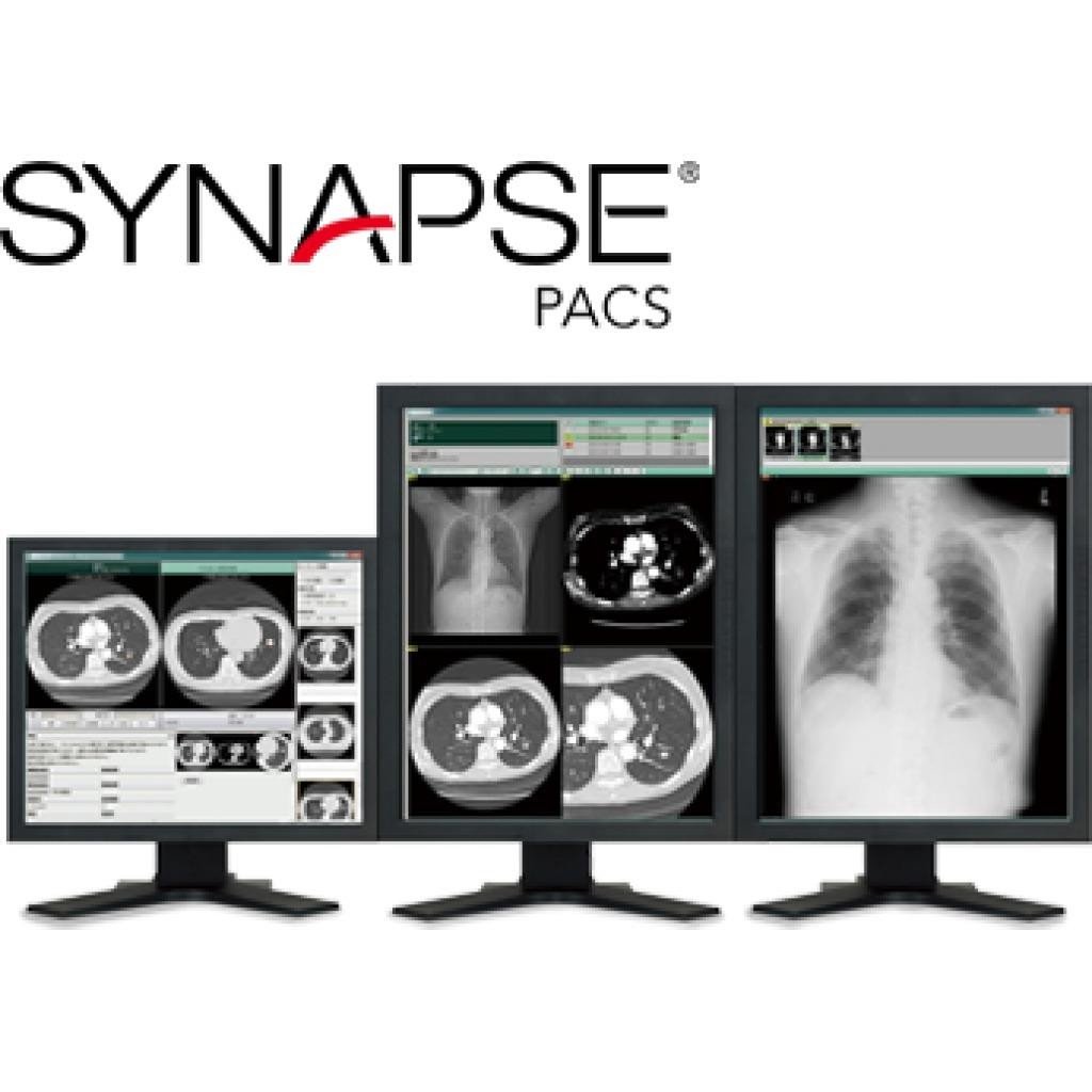 FUJIFILM Synapse PACS medical imaging management by Sahara Medika Prima