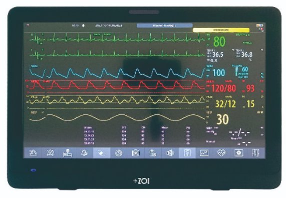 ZOI Patient Monitor vital signs system supplied by Sahara Medika Prima