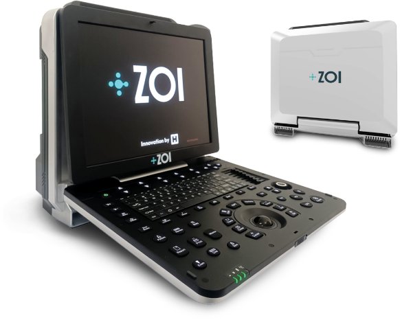 ZOI USG Portable System from Sahara Medika Prima Indonesia